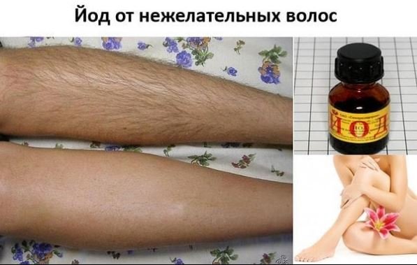 Убираем волосы навсегда. Популярное и действенное средство