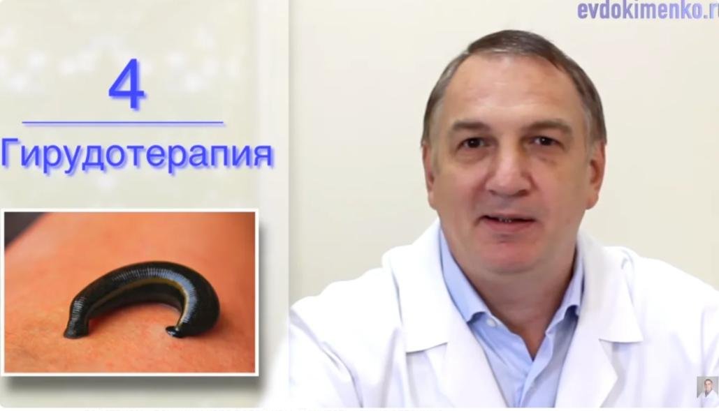 Вот как без лекарств разжижать кровь. Никакого атеросклероза и тромбофлебита